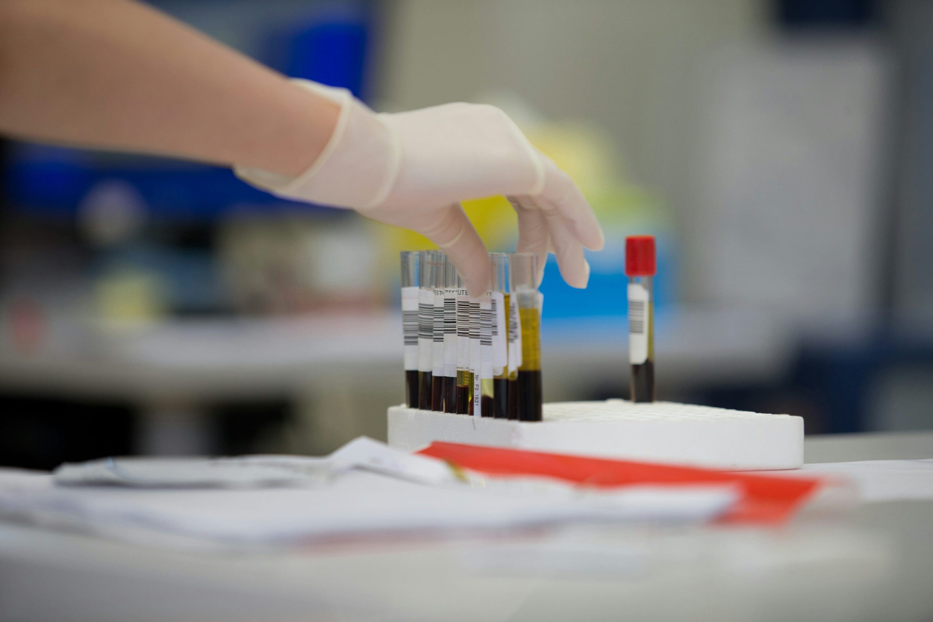 A person holding a blood sample in their hand.